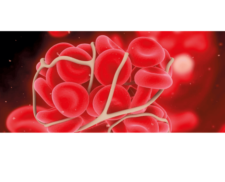 გენეტიკური-თრომბოფილია